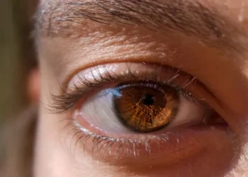 उच्च रक्तचापका लक्षण आँखाबाटै देखिन सक्छन्, समयमै जाँच नगरेमा दृष्टि गुम्न सक्ने खतरा