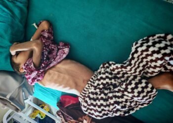 बनेपाको बिग केयर अस्पतालमा अब अटिजम र क्यान्सरको उपचार न्यून शुल्कमा सम्भव