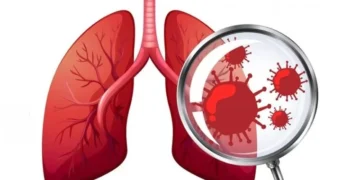 चौध वर्षमुनिका २७ जनामा क्षयरोग