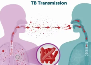 कञ्चनपुरको शुक्लाफाँटामा क्षयरोगीको सङ्ख्या बढ्दो