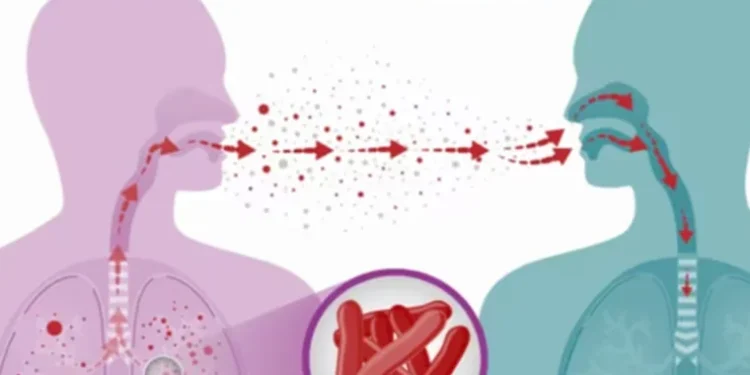 कञ्चनपुरको शुक्लाफाँटामा क्षयरोगीको सङ्ख्या बढ्दो